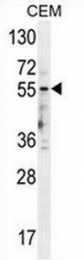 AP50002PU-N - Serotonin receptor 3E (HTR3E)