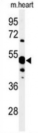AP50003PU-N - NT5C1A