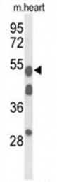 AP50004PU-N - Alpha-1B-glycoprotein / A1BG