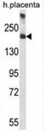 AP50006PU-N - Alpha-2-macroglobulin / A2M