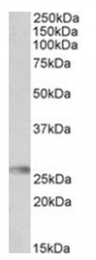 AP31719PU-N - HLA-DQA2