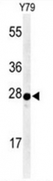 AP50011PU-N - Serotonin acetylase
