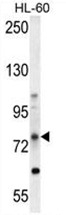 AP50017PU-N - ABCD1 / ALDP