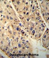 AP50017PU-N - ABCD1 / ALDP
