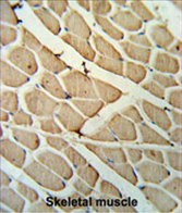 AP54605PU-N - YTHDF3