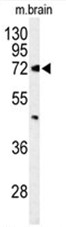 AP50018PU-N - ABCD2 / ALDR