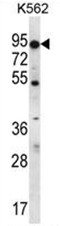 AP50019PU-N - ABCD2 / ALDR