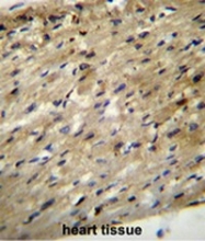 AP50019PU-N - ABCD2 / ALDR