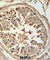 AP50022PU-N - ABCF1