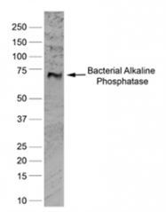 BM217 - Alkaline phosphatase / ALPL