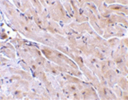 SP2172P - RNF216