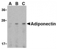 SP2182P - Adiponectin