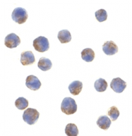 SP2182P - Adiponectin