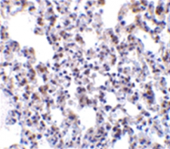 SP2167P - BCAP31 / BAP31