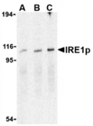AP05555PU-N - ERN1 / IRE1