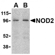 AP05557PU-N - CARD15 / NOD2