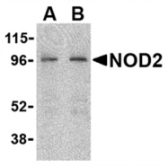 AP05558PU-N - NOXA