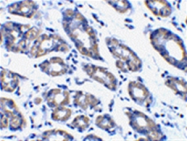 AP05558PU-N - NOXA