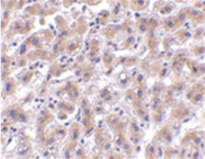 AP05559PU-N - HTRA2 / PRSS25