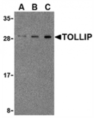 AP05562PU-N - TOLLIP