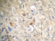 SP2184P - CD154 / CD40L