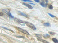 SP2184P - CD154 / CD40L