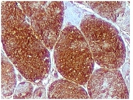 AP10436PU-N - Myoglobin
