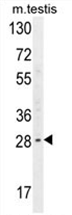 AP54593PU-N - YDJC