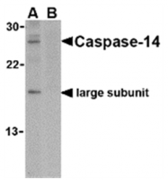 AP05590PU-N - Caspase-14