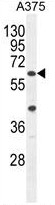 AP50047PU-N - APOBEC1 complementation factor