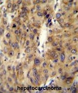 AP50047PU-N - APOBEC1 complementation factor