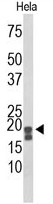 AP50056PU-N - ACP1 / LMW-PTPase