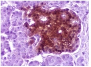 AM00578SU-N - Neuron specific enolase