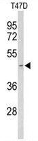 AP50058PU-N - Acrosin / ACR