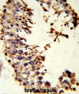 AP50058PU-N - Acrosin / ACR