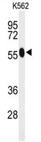 AP50063PU-N - ACSM1