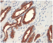 AM10136SU-N - ACPP / Prostatic acid phosphatase