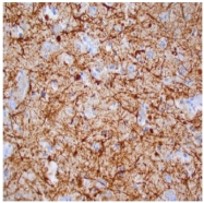 DM080X - Neurofilament L (68kDa)