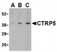 AP05591PU-N - C1QTNF5