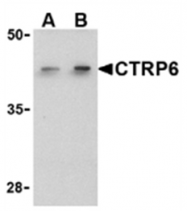 AP05592PU-N - C1QTNF6