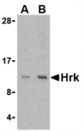 AP05593PU-N - Harakiri / HRK