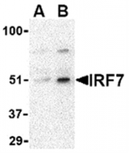 AP05594PU-N - IRF7