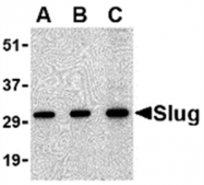 AP05600PU-N - SNAI2 / SLUG