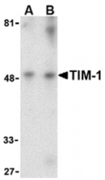 AP05601PU-N - TIMD1 / HAVCR1