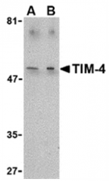 AP05602PU-N - TIMD4