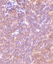 AP05605PU-N - PAK2