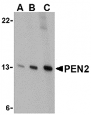 AP01104PU-N - PEN2