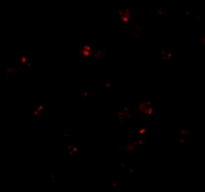 AP01104PU-N - PEN2