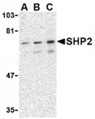 AP05610PU-N - PTPN11 / PTP2C