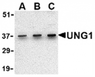 AP05613PU-N - Uracil-DNA glycosylase (UNG)